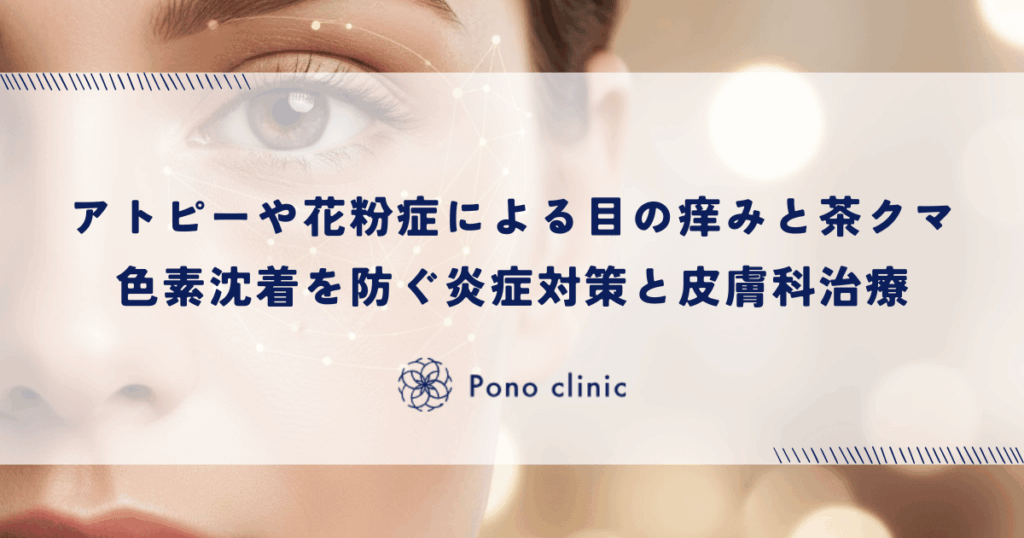 アトピーや花粉症による目の痒みと茶クマ｜色素沈着を防ぐ炎症対策と皮膚科治療