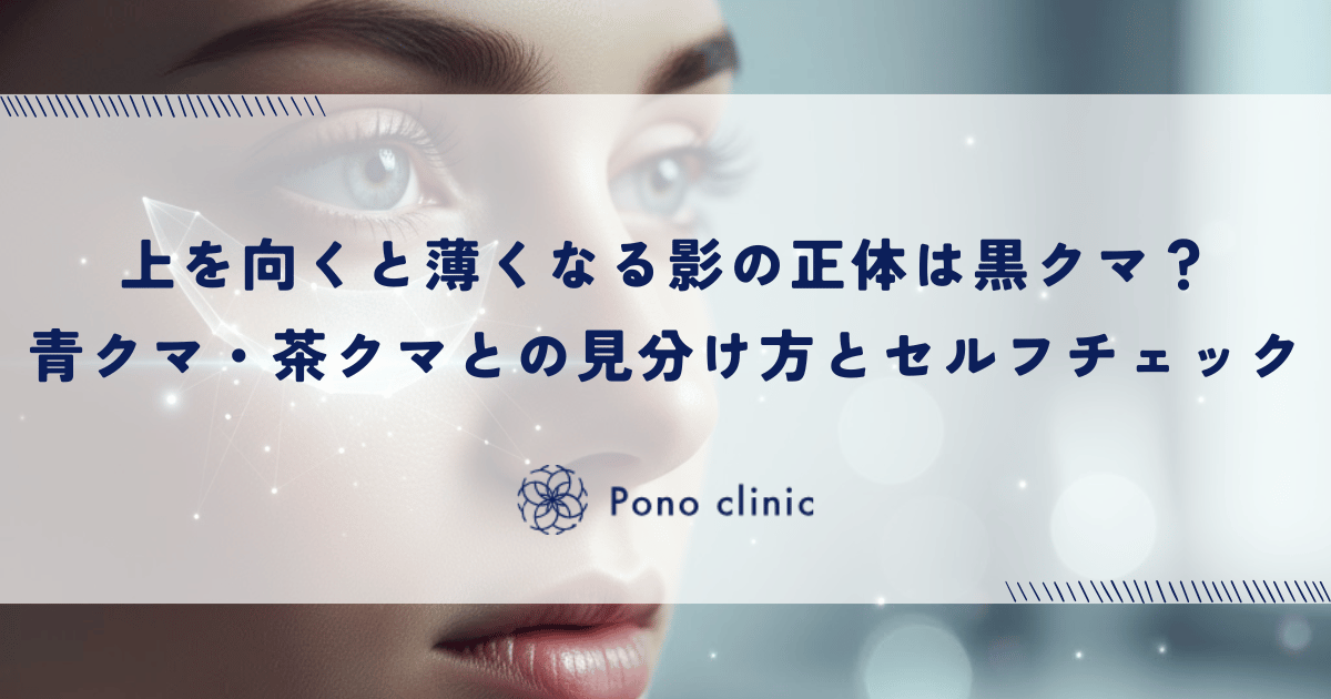 上を向くと薄くなる影の正体は黒クマ?青クマ・茶クマとの見分け方とセルフチェック