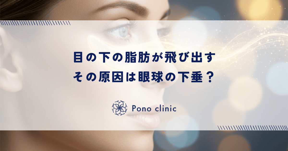 目の下の脂肪が飛び出す原因は眼球の下垂?ロックウッド靭帯の緩みとヘルニアの仕組み