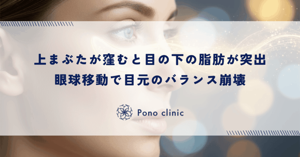 上まぶたが窪むと目の下の脂肪が突出する｜眼球の移動が招く目元のバランス崩壊