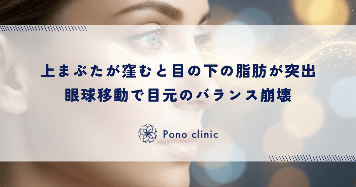 上まぶたが窪むと目の下の脂肪が突出する｜眼球の移動が招く目元のバランス崩壊